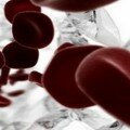 analizy-pri-zhelezodeficitnoj-anemii