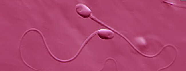analizy-spermy-i-spermogramma 